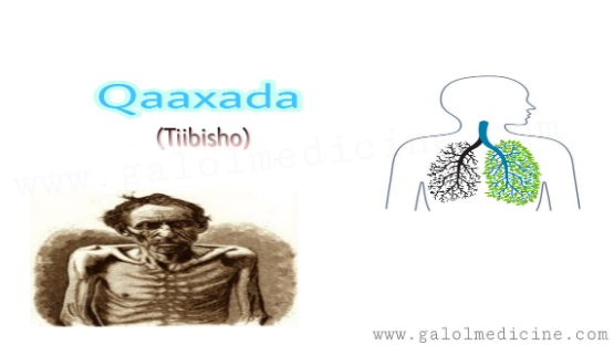 Read more about the article Qaaxada(Tiibisho)