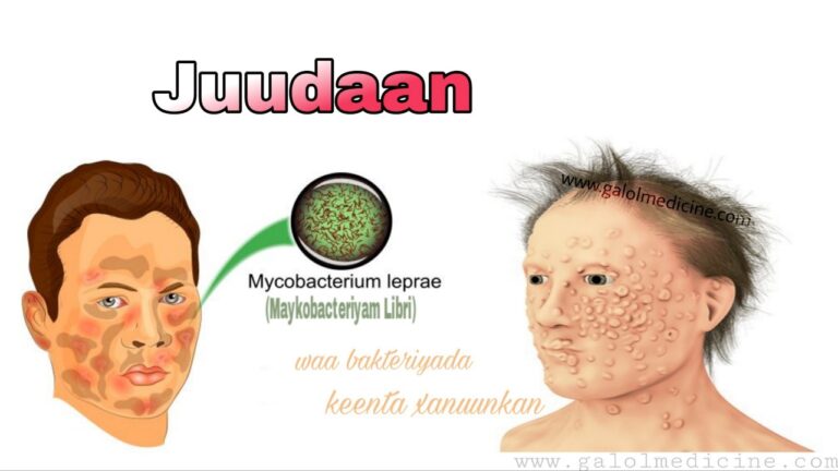 Read more about the article Juudaan