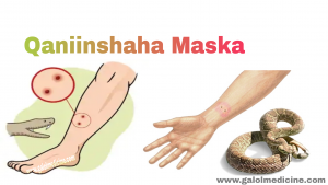 Read more about the article Qaniinyada Maska
