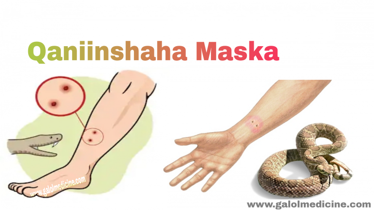 Read more about the article Qaniinyada Maska