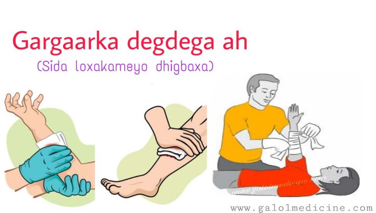 Read more about the article Sida loo xakameyo dhigbaxa
