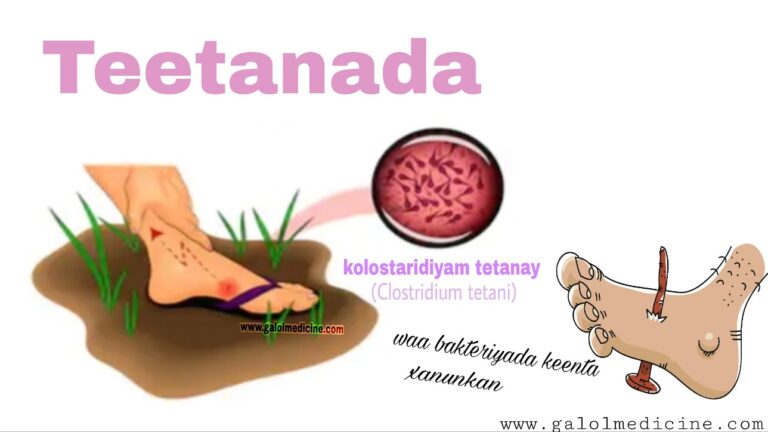 Read more about the article Teetanada