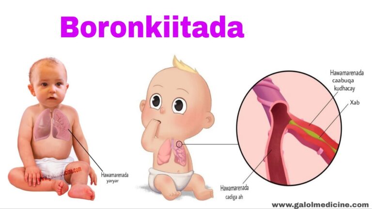 Read more about the article Boronkiitada