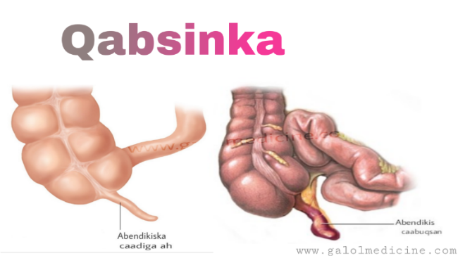 Read more about the article Qabsinka