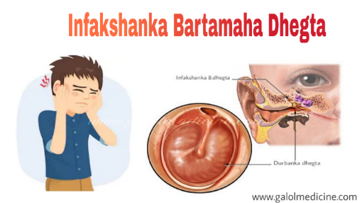 Read more about the article Infakshanka Bartamaha Dhegta