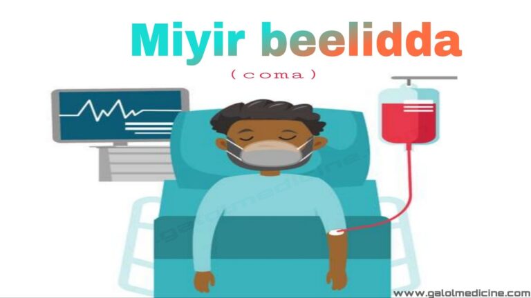 Read more about the article Miyir Beelidda(Coma)