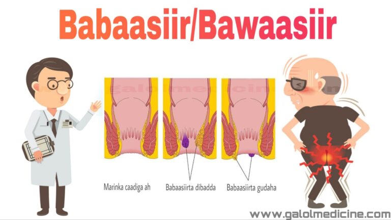 Read more about the article Babaasiir(Bawaasiir)