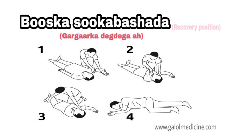 Read more about the article Booska Sokabashada