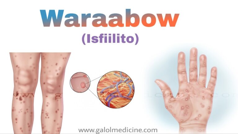 Read more about the article Waraaboow(Isfiilito)