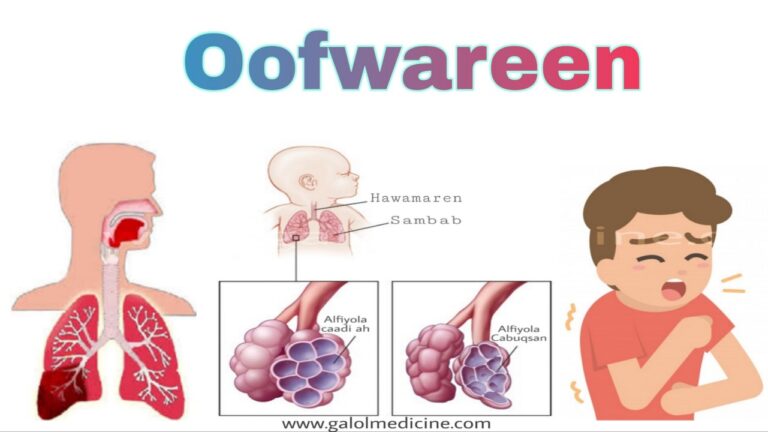 Read more about the article Oofwareen