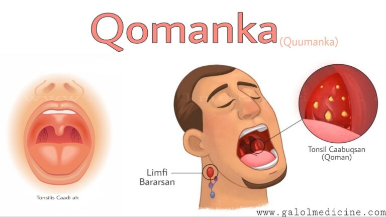 Read more about the article Qomanka(Quuman)