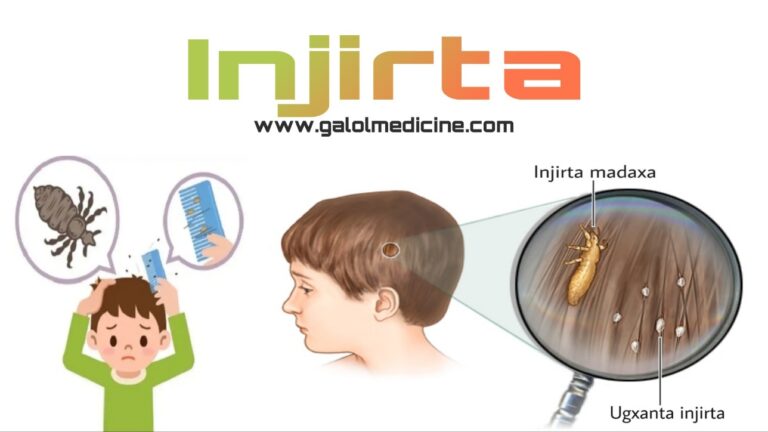 Read more about the article Injirta