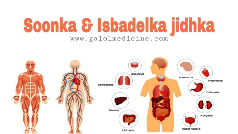 Read more about the article Soonka iyo Isbadelka Jidhka