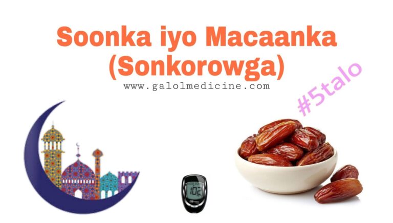 Read more about the article Soonka iyo Macaanka (Sonkorowga)