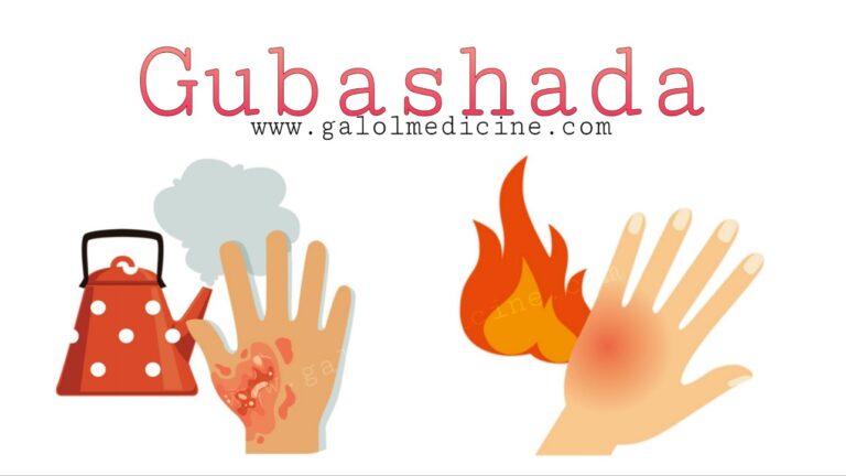 Read more about the article Gubashada