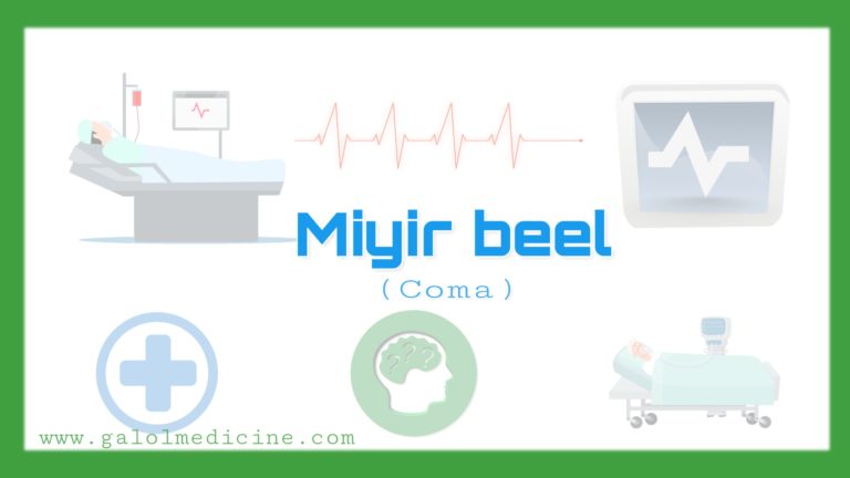 Read more about the article Miyir beelidda(Coma)