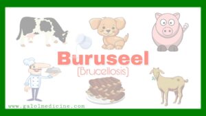 Buruseel(Brucellosis) - Galolmedicine