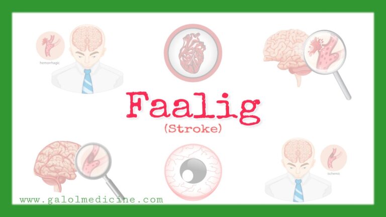 Read more about the article Faalig