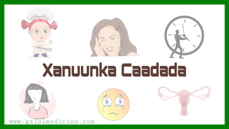 Read more about the article Xanuunka Caadada