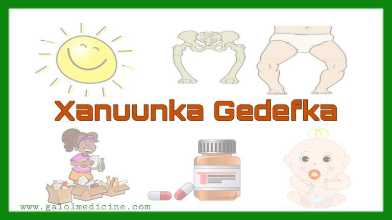 Read more about the article Xanuunka Gedefka