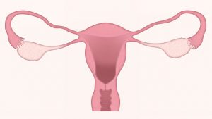 Jaantuska Uteruska ama Fallopian tube ka Haweenka/Dumarka